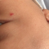 着急，有没有宝妈知道宝宝脸上 长的是什么不，刚出生的时候没有，半个月之后长的，现在已经一个月了还没...