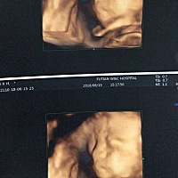 四维彩超，像不像姐姐，我看是比较像，老公说看不出来.