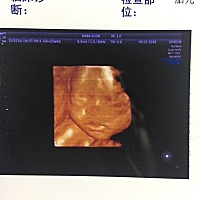 哈哈，宝宝的四维出来了，睡的香香的，手指都不愿意张开！感觉丑丑的，能看得出男女宝吗？