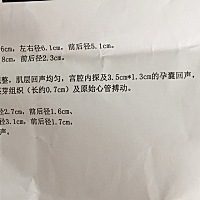 三胎了，想知道男女，有懂的帮忙看看