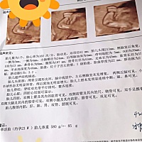 接好运🍀猜猜是妹妹还是弟弟？