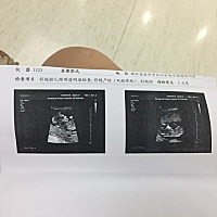 各位宝妈 看得出来男宝女宝吗？