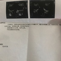 第一次b超，大家看下