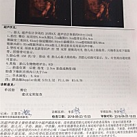 孕妈们！能看出来是小哥哥还是小姐姐吗？