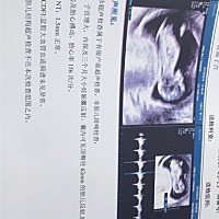 胎心心跳150以上一定是女儿么？