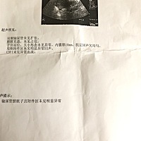 月经推迟2天 昨天彩超和早孕试纸都没有查到怀孕，子宫内膜厚10mm，医生说可能是快来月经了，也有可能是...