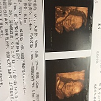 四维顺利通过，会看的宝妈的帮我看看像男宝还是女宝！男宝女宝都是我最爱，