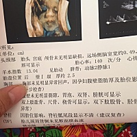 26周的四维图，大家看看男孩还是女孩