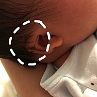 今天家庭医生来看宝宝，说宝宝的耳朵异常要我出了月子去医院检查看看，才坐了一个礼拜月子现在好担心啊...