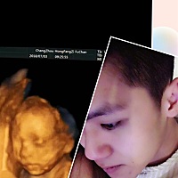 四维顺利通过，已确定女宝，跟我老公长得太像了，除了额头，全像他