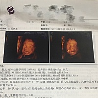四维彩超顺利通过，期待我的coco美眉