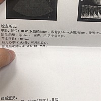 能看出男宝女宝么