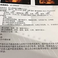 四维，过了。能看出是男孩还是女孩么？