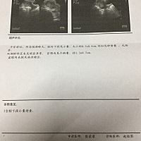 各位辣妈们 5月21日末次月经 7月7日验孕棒检测线浅浅的，7月10日才深些 回来去中医做了个比超说孩子往下...