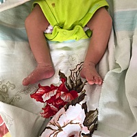 出生那天接生的医生说有点像足内翻，但是不典型，让我观察着看，42天体检的时候才让医生看看，有懂的宝...