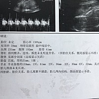 这正常吗？是男是女