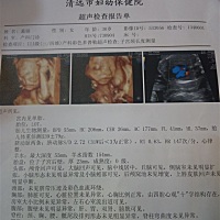 各位宝妈:会看四维彩超男女的给给意见，想求儿女双全，不只有有没有那个福气