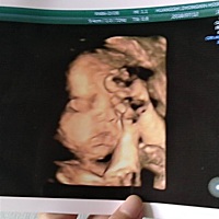 大排畸一次过，照片没拍好，小排畸一次过，终于拍好照片了，宝宝今天很给力！愿每位宝妈都能顺顺利利的...