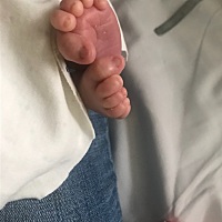 终于终于把这坨怀了10个月会呼吸的陈年老💩拉了出来。男宝，顺转剖。6.8斤。分享一下我的经历吧。预产...