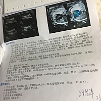 好奇，宝妈们帮忙看看是男孩还是女孩！