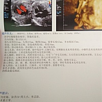 有谁会看是男宝还是女宝呢？