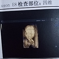 看一下男宝还是女宝(づ￣ ³￣)づ
