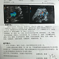 刚做完排畸，帮忙看看心脏大脑是否正常，谢啦！