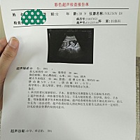 有没有会看男女的，二胎想要个小公主