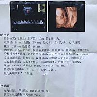 各位小伙伴们帮忙看看是男宝还是女宝，二胎还是很好奇呀