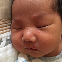 宝宝脸上长得这个红红的白点是什么，好几天了，一直没好，求解