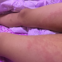 有没有宝妈知道这是怎么了 孩子身上出的  医生也没给开药