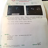 40周＋4宝宝还不出来，偏小了四周