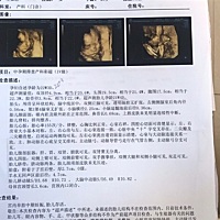 有没有宝妈看得懂是男宝宝还是女宝宝呀。