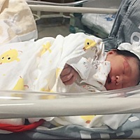 宝宝出生7天 脸上的胎记有知道是什么的吗？能自己消退吗？揪心！这两天又黄疸17吃药中。