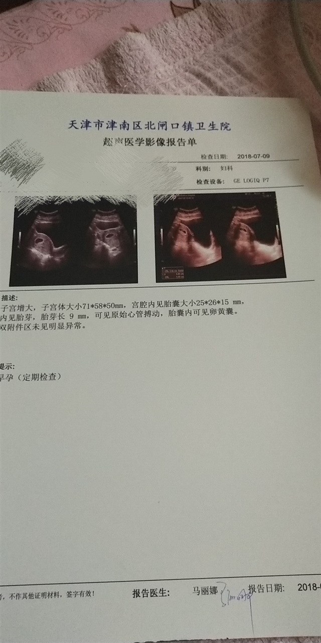 想知道这是怀孕几周了