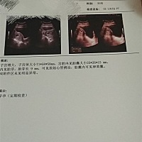 想知道这是怀孕几周了