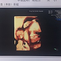 今天做四维通过  大家看看是男宝女宝