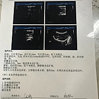 有认识儿科的医生吗？这个 肝内可见13Ｘ６这里医院说不清楚