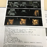 昨天刚做的三维，大家看看是男宝还是女宝呀