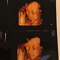 越来越大啦  30周宝宝😊