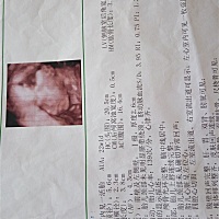 之前做了三维，宝宝老是不配合，一直趴着，就是不让看脸，做了三次才过，不知道是男宝还是女宝？每次老...