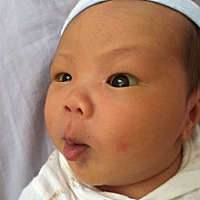 黄疸测试偏高。除啦蓝光还有其他的吗？