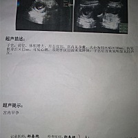 今天刚照的b超，帮忙看下几个月了，有没有成型？男生还是女生？