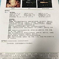 各位宝妈知道是男孩还是女孩吗？