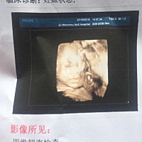 👀到宝贝很激动，觉得好可爱就好奇是男宝还是女宝，