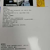 怀孕12+2让大家帮看看男孩 还是女孩