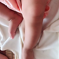 宝妈们我家宝宝从出生小腿就不直，现在两个月了。怎么办啊，以后会不会是罗圈腿啊。╰😱╯╰😱╯╰...