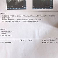 各位帮我看一下是不是快排卵了