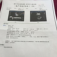 大家帮我看看能不能顺产。都38周他都还那么淡定