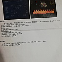 第一胎是女儿，目前二胎我老公说决定要生就不管男女，可是我婆婆就会在我面前念叨着叫我生个男娃就不生...